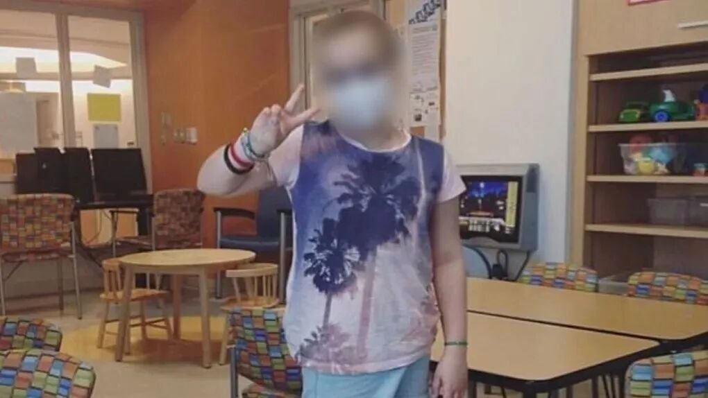 松果體區腫瘤案例圖片